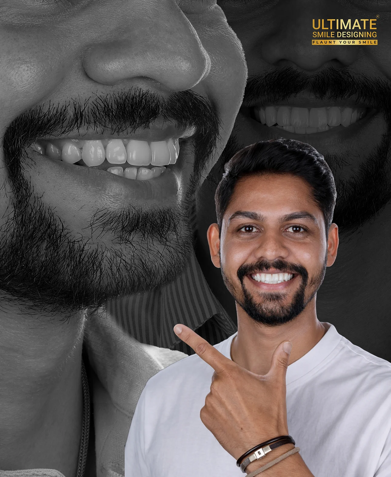 World-class smile design transformation before and after