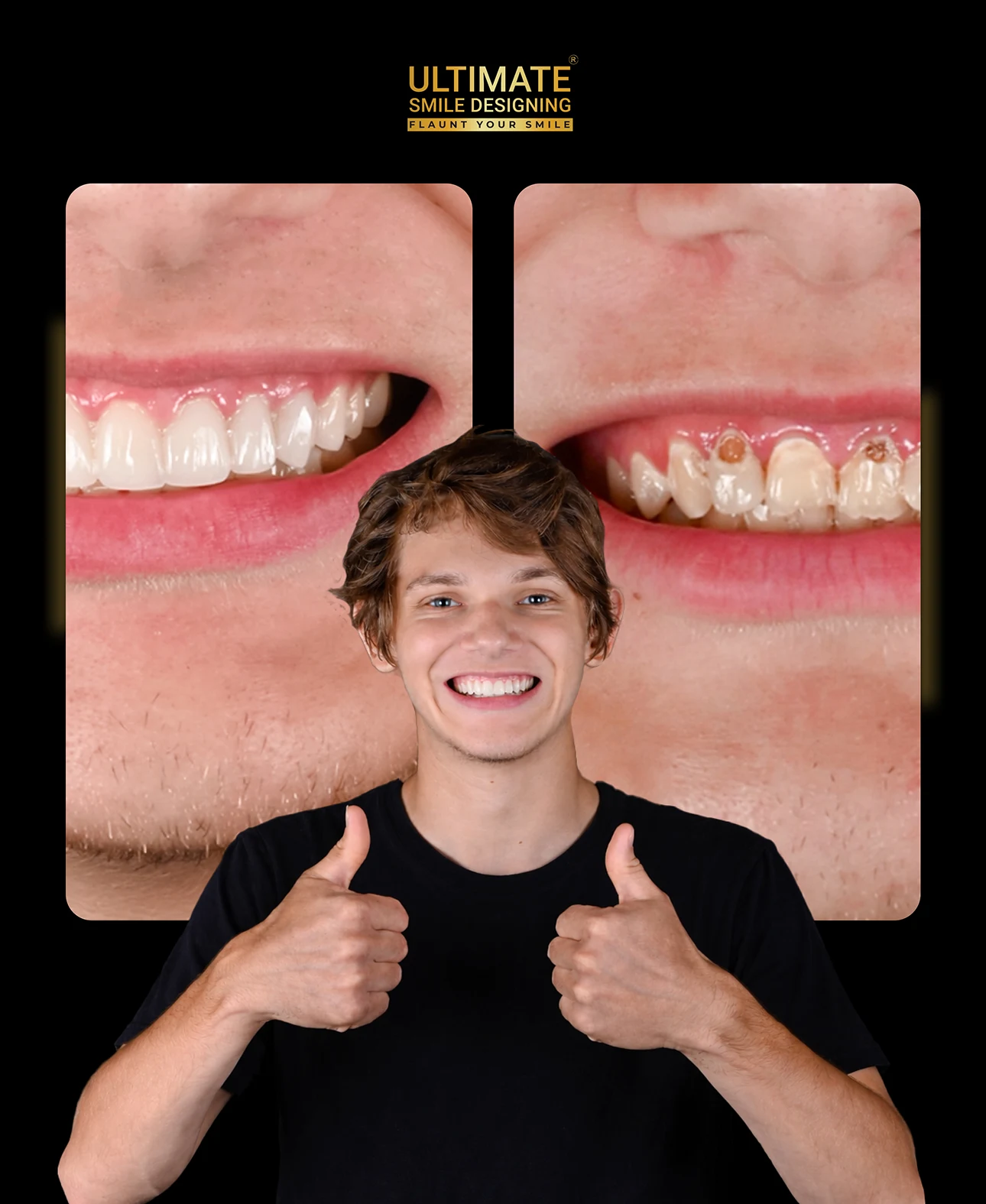 Confidence-boosting smile transformation before and after