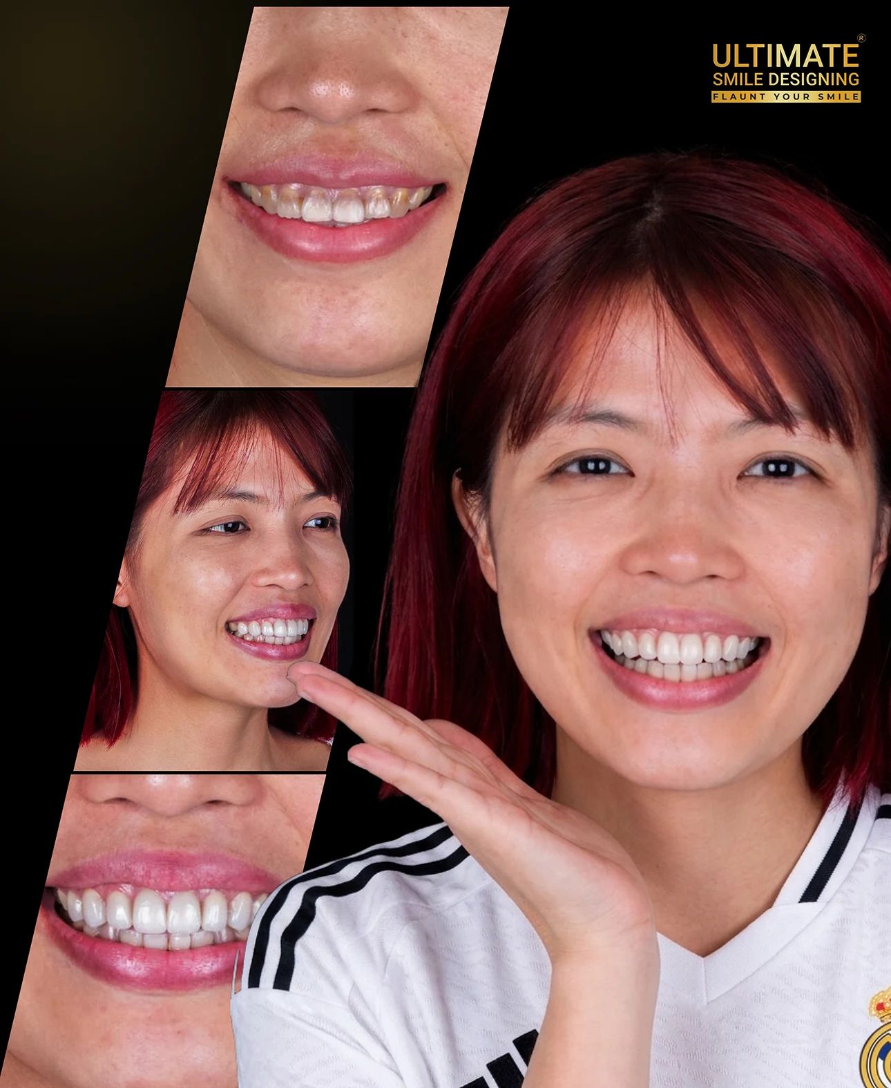 Professional smile design results before and after treatment