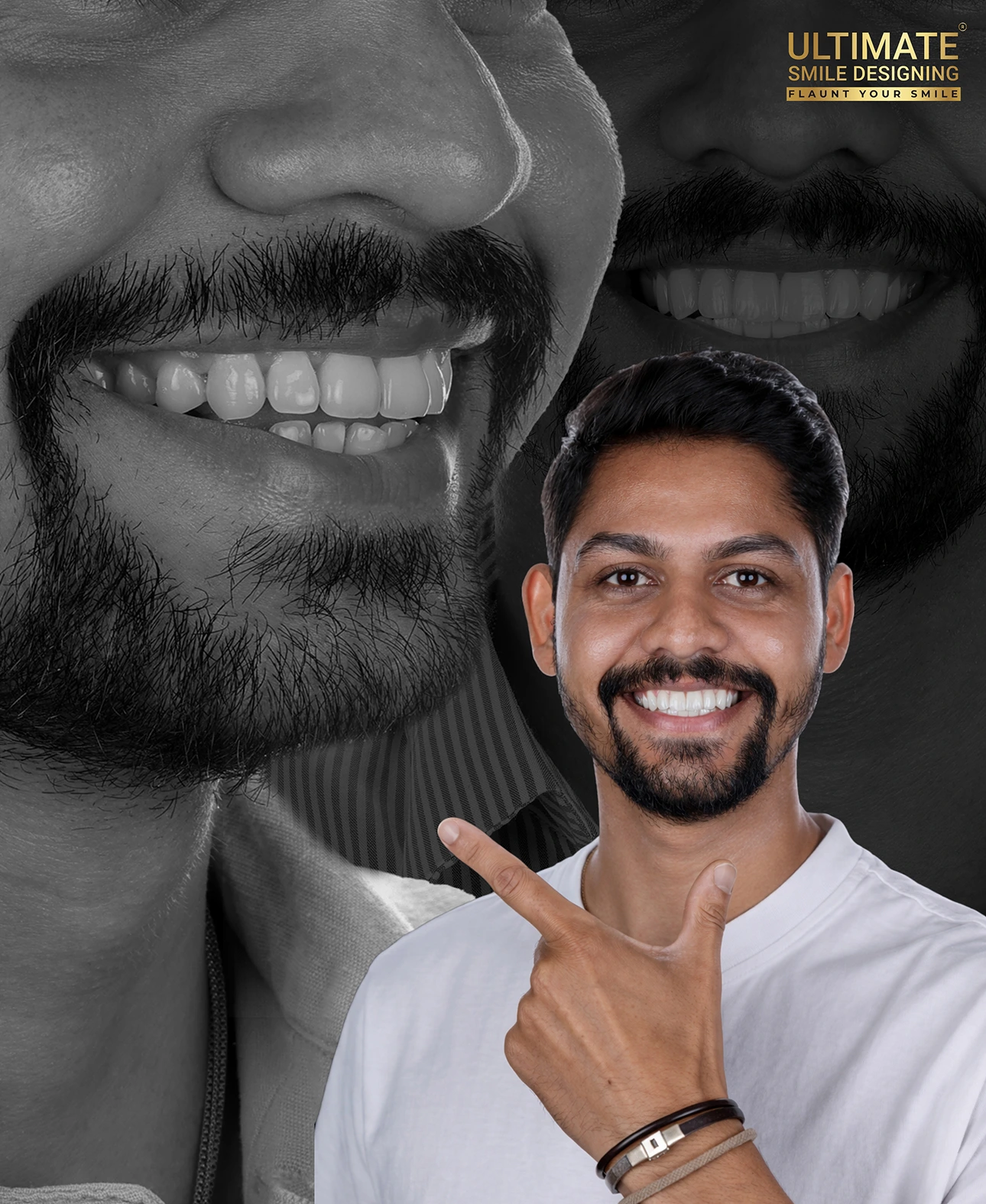 World-class smile design transformation before and after