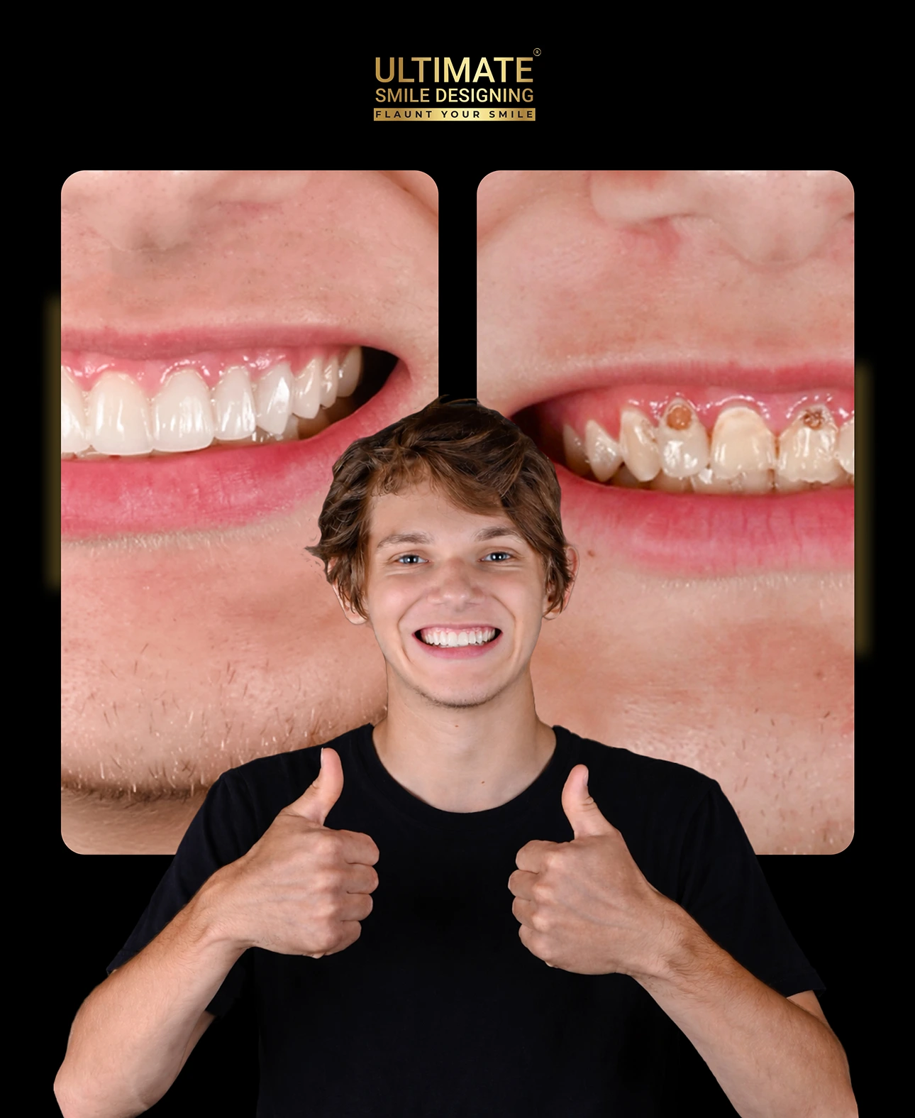 Confidence-boosting smile transformation before and after