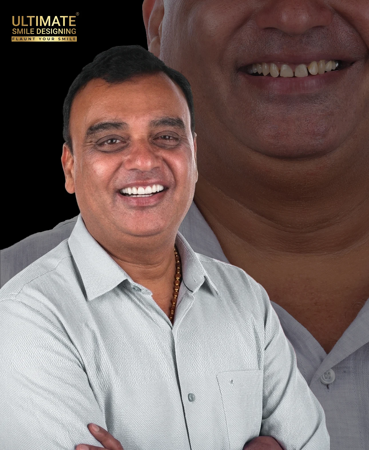 Dental makeover before after