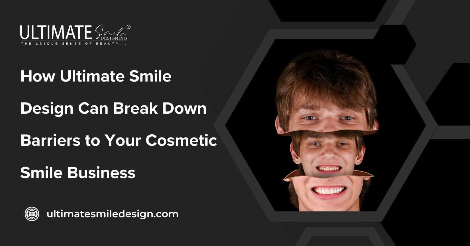 How Ultimate Smile Design Can Break Down Barriers to Your Cosmetic Smile Business