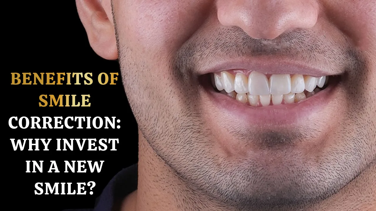 Benefits-of-Smile-Correction-Why-Invest-in-a-New-Smile