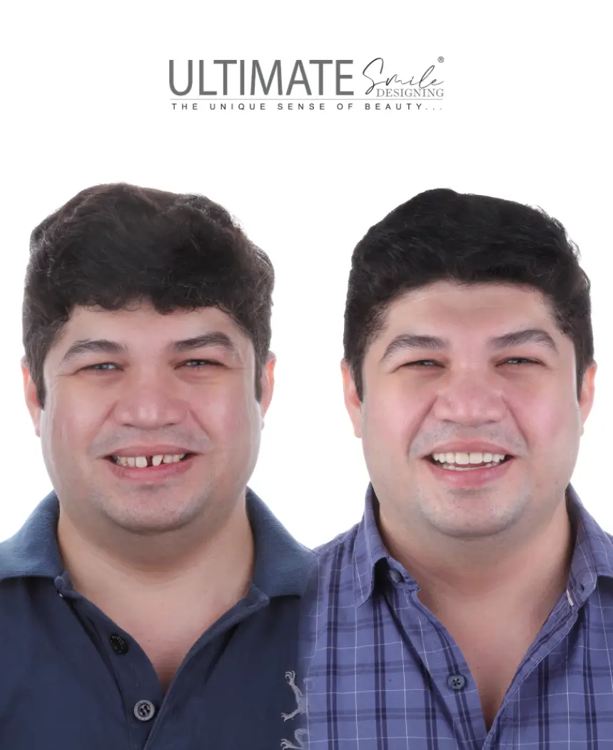single-image-2