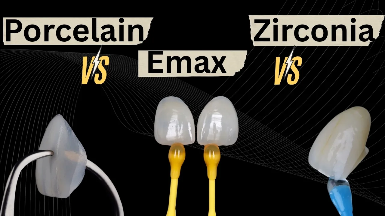 Emax-Vs-Porcelain-Vs-Zirconia-Veneers