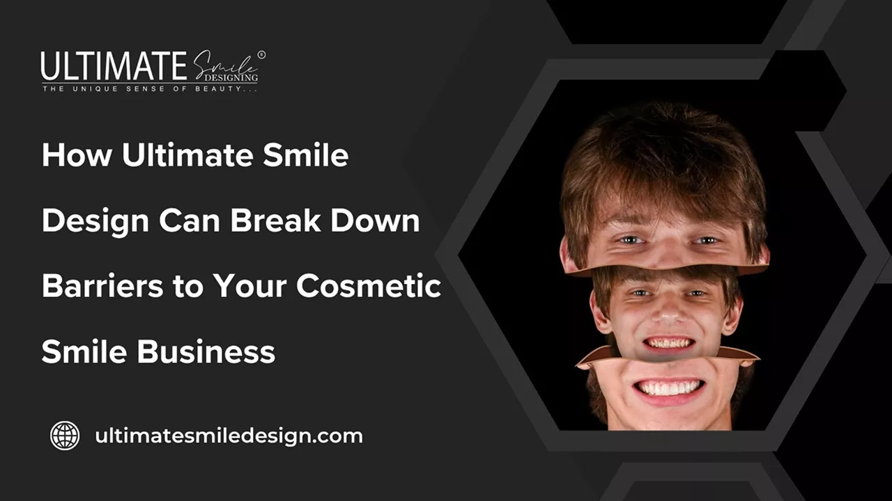 How Ultimate Smile Design Can Break Down Barriers to Your Cosmetic Smile Business