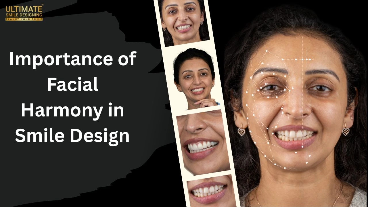 Importance of Facial Harmony for a Confident Smile Design