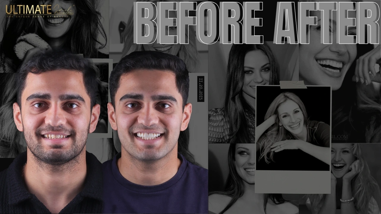 Improving-Smile-Communication-with-Smile-Design