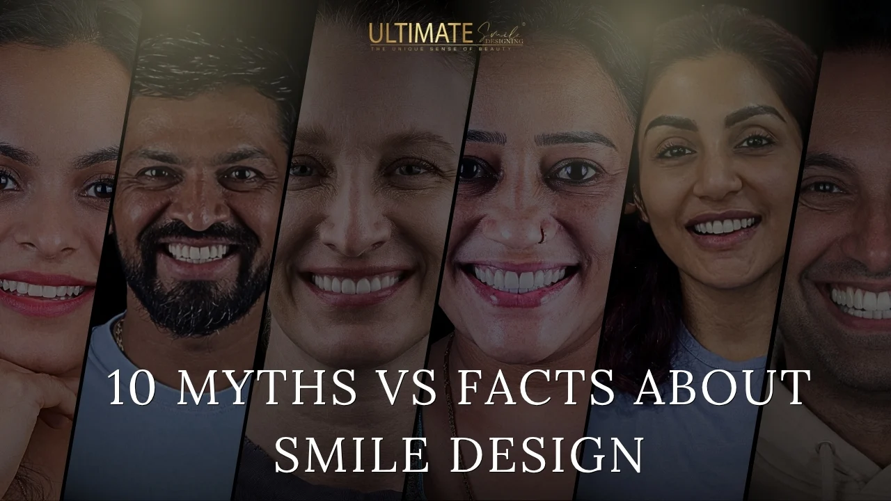 Is Smile Design Safe? 10 Myths & Facts Explained by Experts