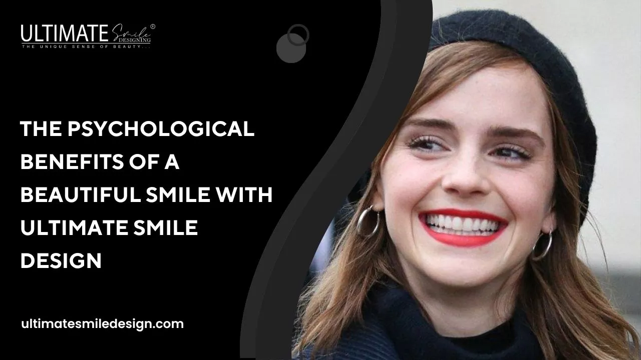The Psychological Benefits of a Beautiful Smile with Ultimate Smile Design
