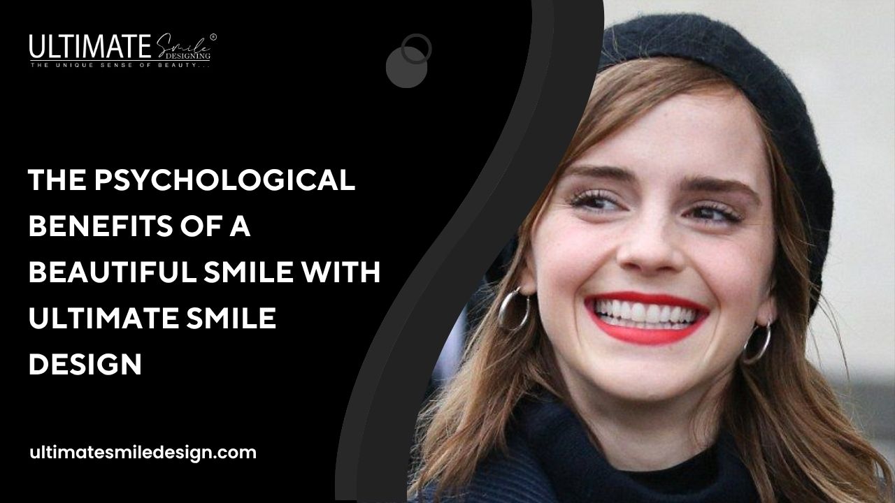 The Psychological Benefits of a Beautiful Smile with Ultimate Smile Design