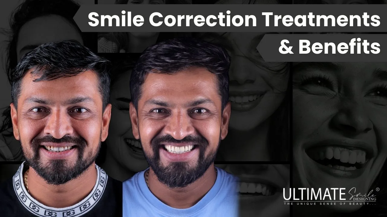 Smile Correction (Smile Makeover): Treatments & Benefits