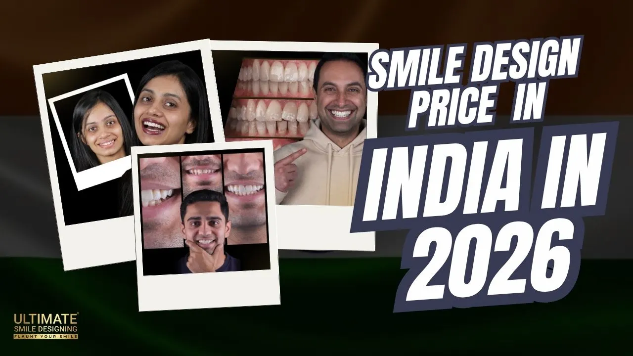 Smile-Design-Price-in-India-in-2026