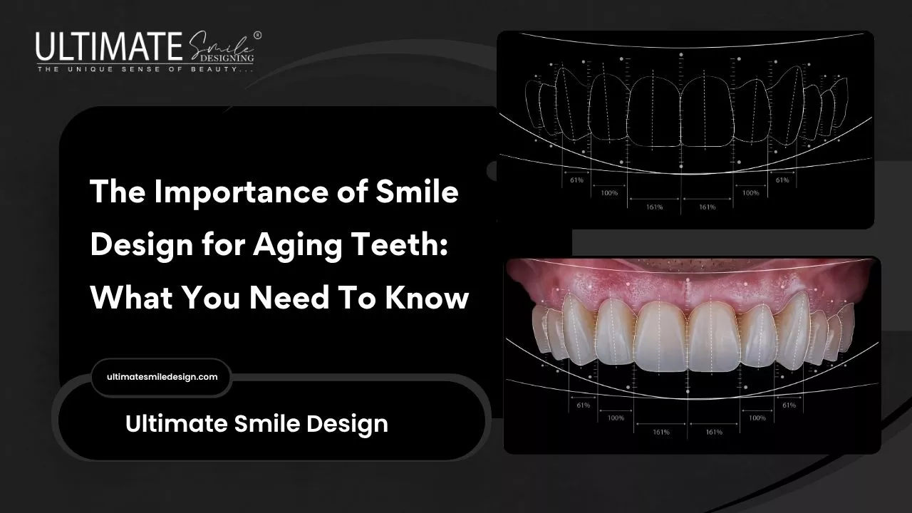 The Importance of Smile Design for Aging Teeth: What You Need To Know