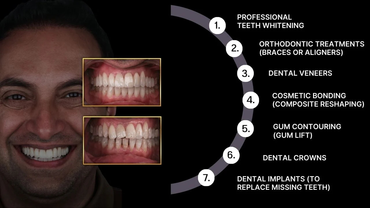 Treatments-and-Procedures-Involved-in-a-Smile-Makeover