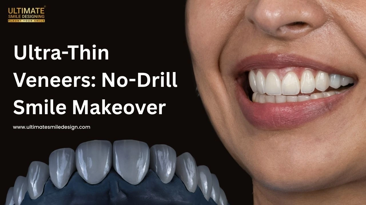 Ultra-Thin Veneers | Get a Natural Smile Without Drilling