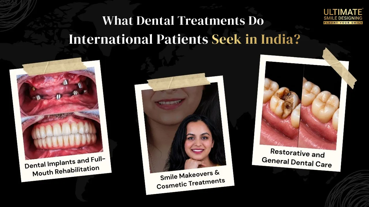 What-Dental-Treatments-Do-International-Patients-Seek-in-India