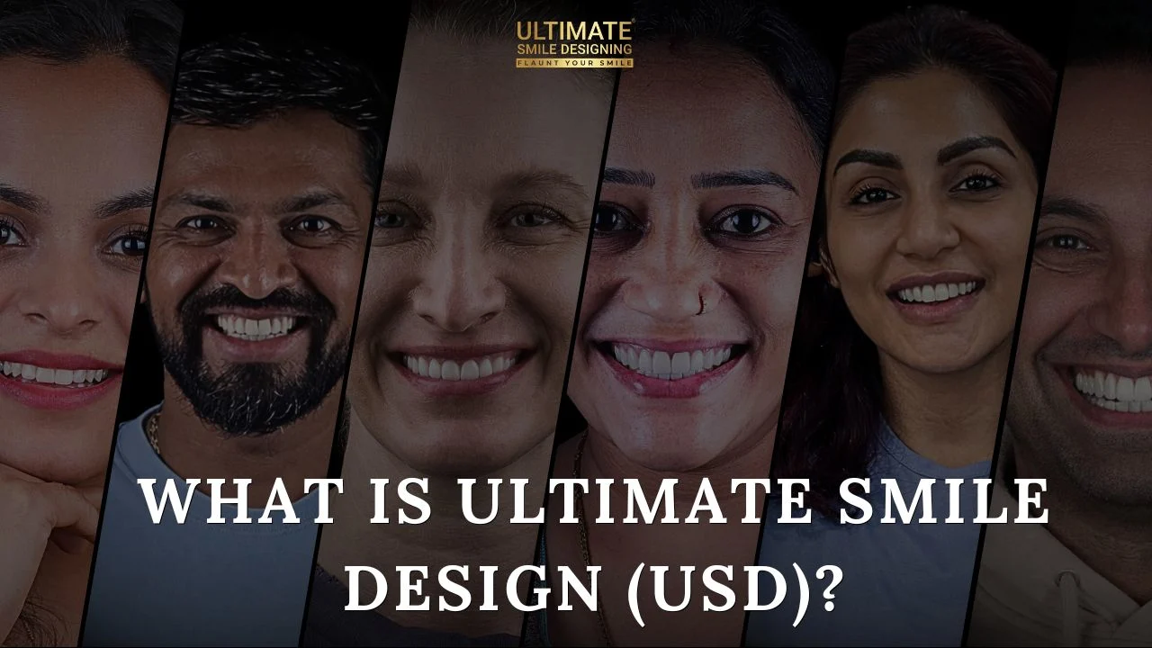 What-is-Ultimate-Smile-Design-(USD)