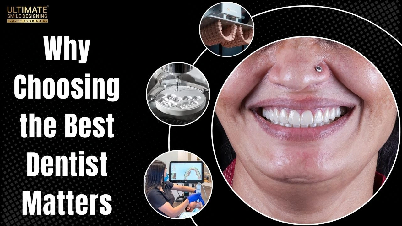 Why-Choosing-the-Best-Dentist-Matters