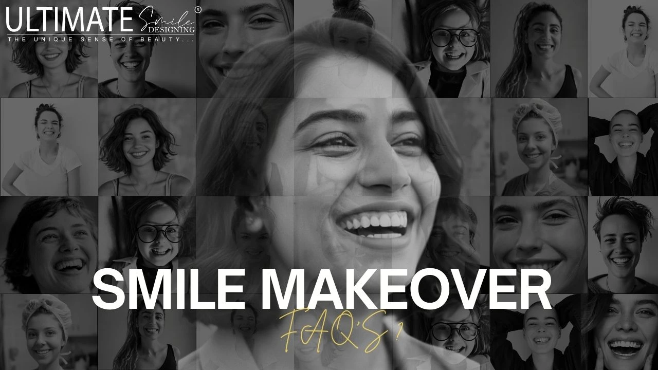 Smile Makeover FAQs: Find Answers to Your 5 Key Questions