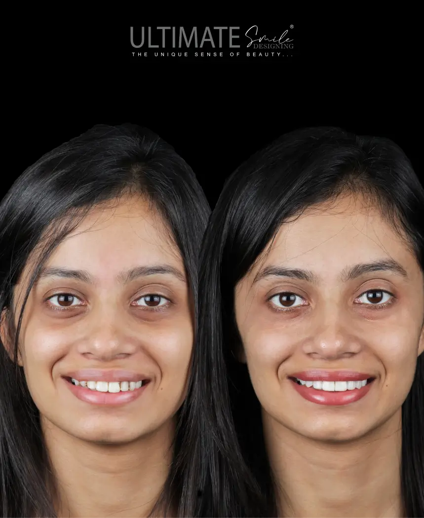 single-image