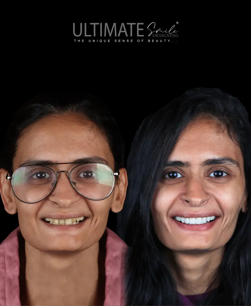 single-image-2