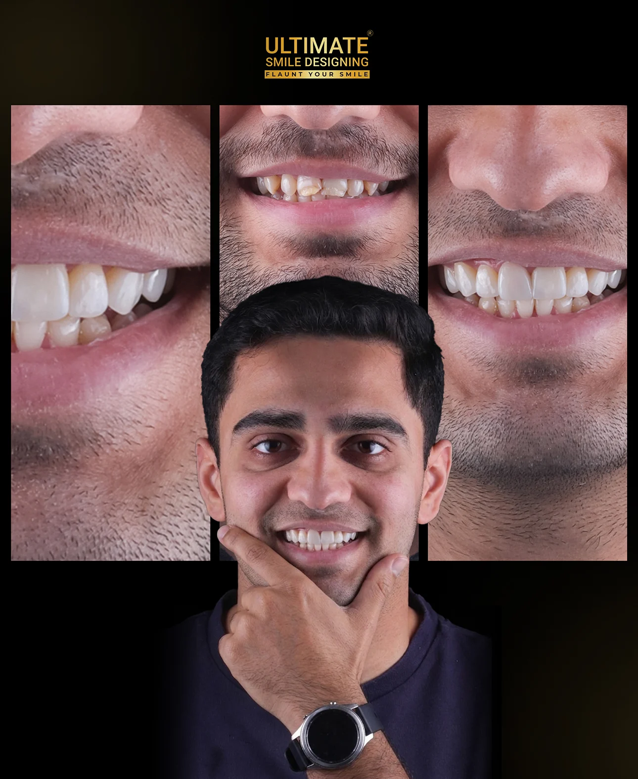 Real transformation gallery from customized dental treatment at Ultimate Smile Design studio