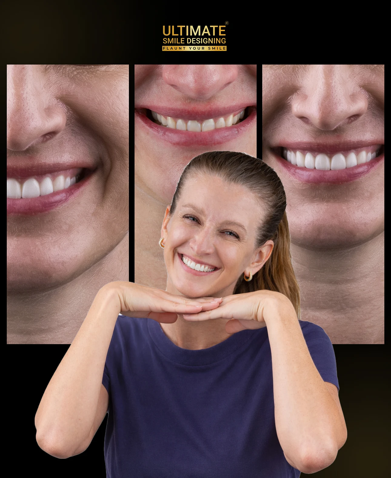 Stunning visual results from personalized smile design captured in patient gallery view