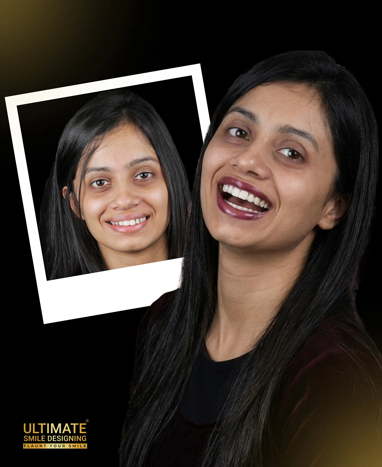 High-impact before-after visuals of confident smiles crafted by expert clinicians