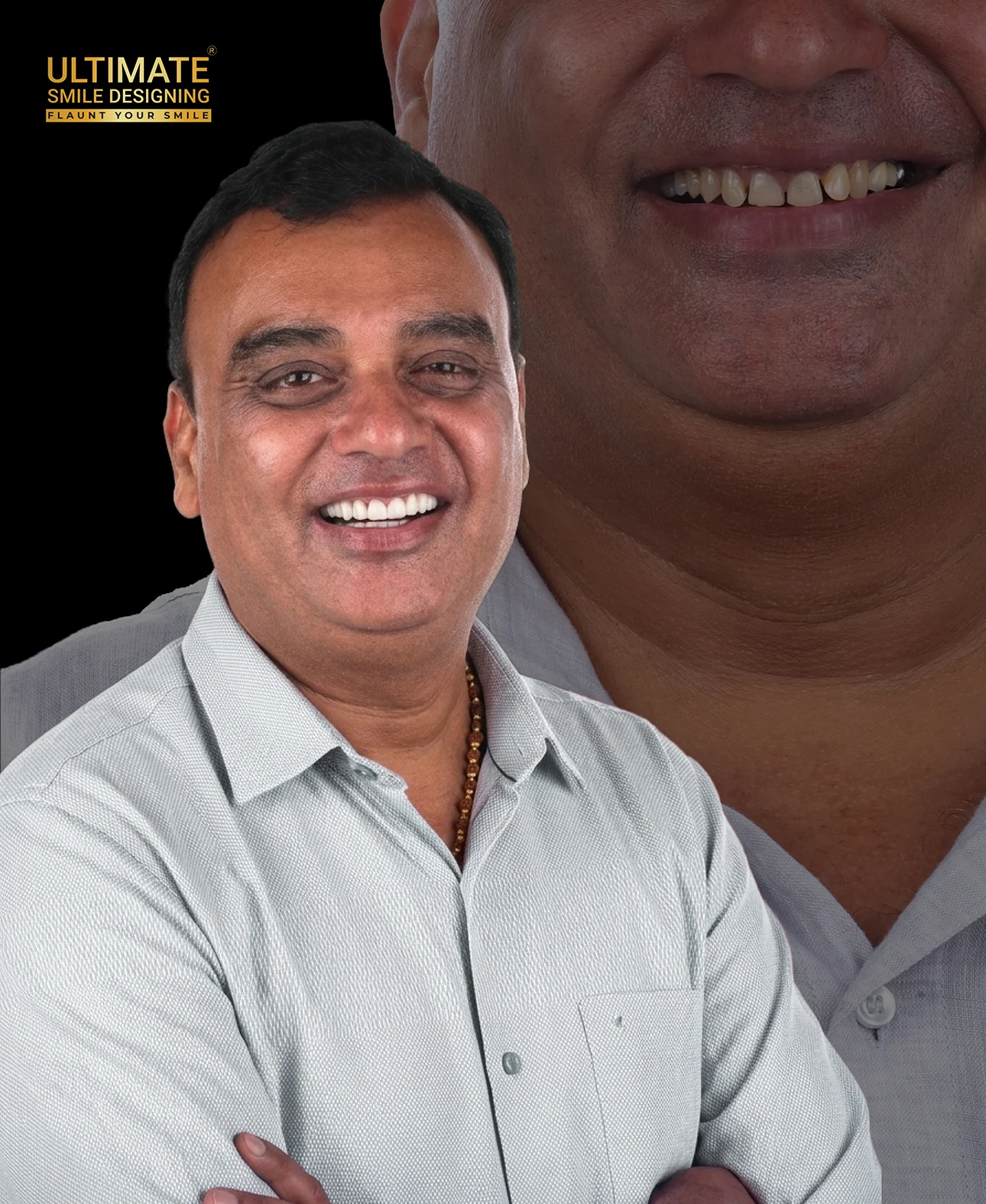 Patient journey from consultation to perfect smile in Ultimate Smile Design series