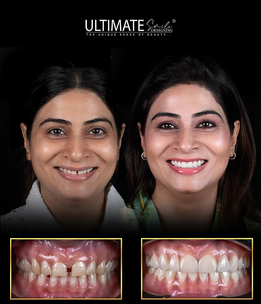 Visible dental improvements through advanced treatment shown in patient image timeline
