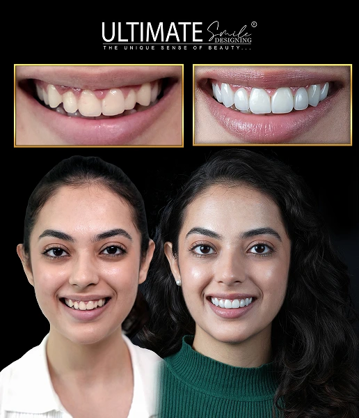 Clinical showcase highlighting artistic smile enhancement and real case outcomes