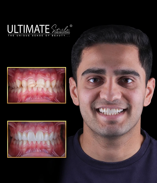 Image timeline of smile success stories from Ultimate Smile Design restorative care