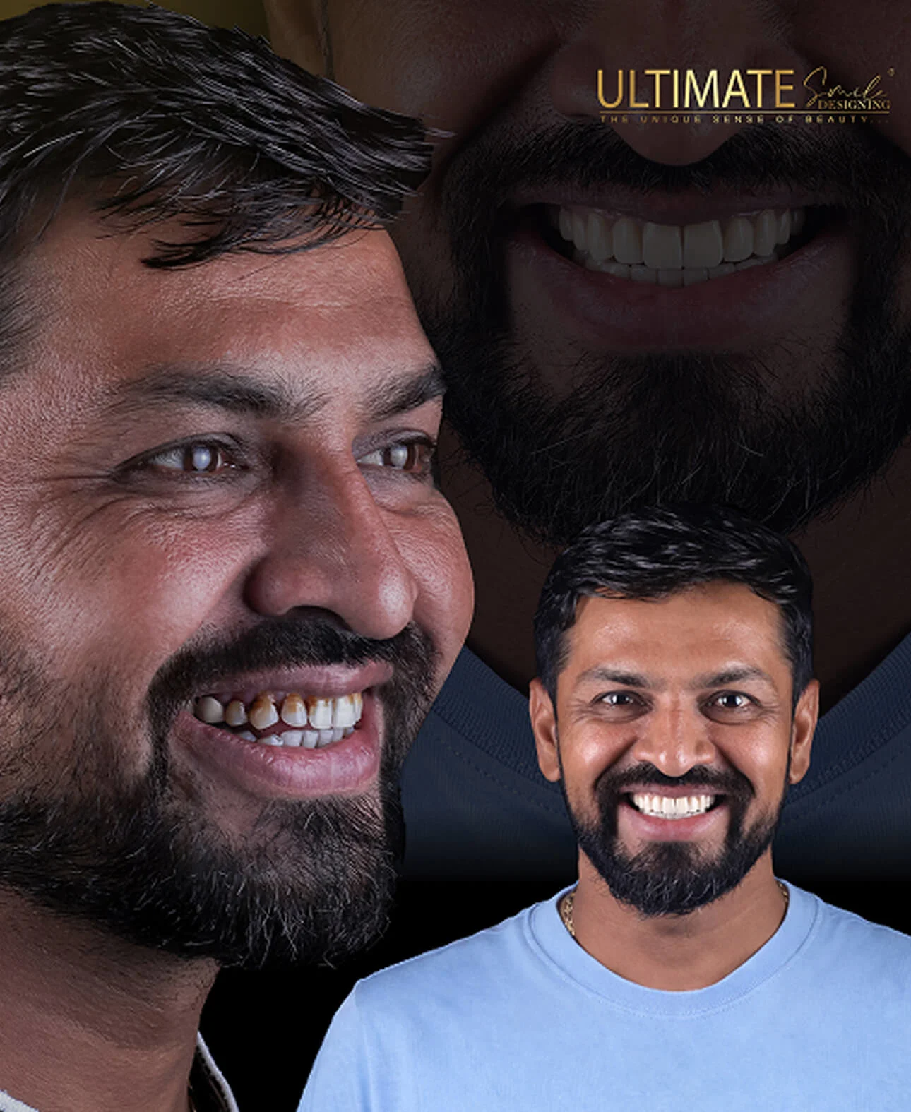 Real transformation gallery from customized dental treatment at Ultimate Smile Design studio