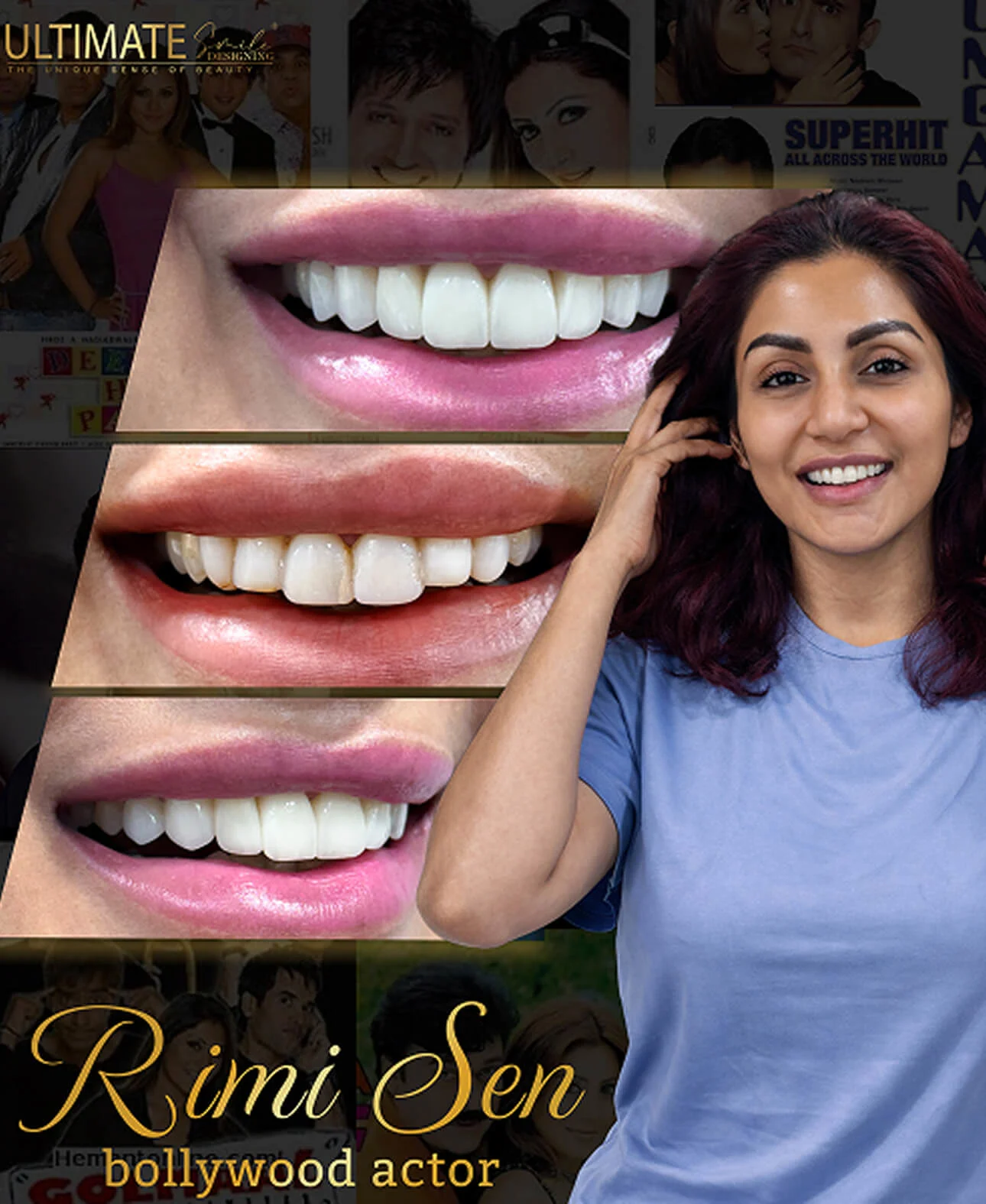 Clinical showcase highlighting artistic smile enhancement and real case outcomes