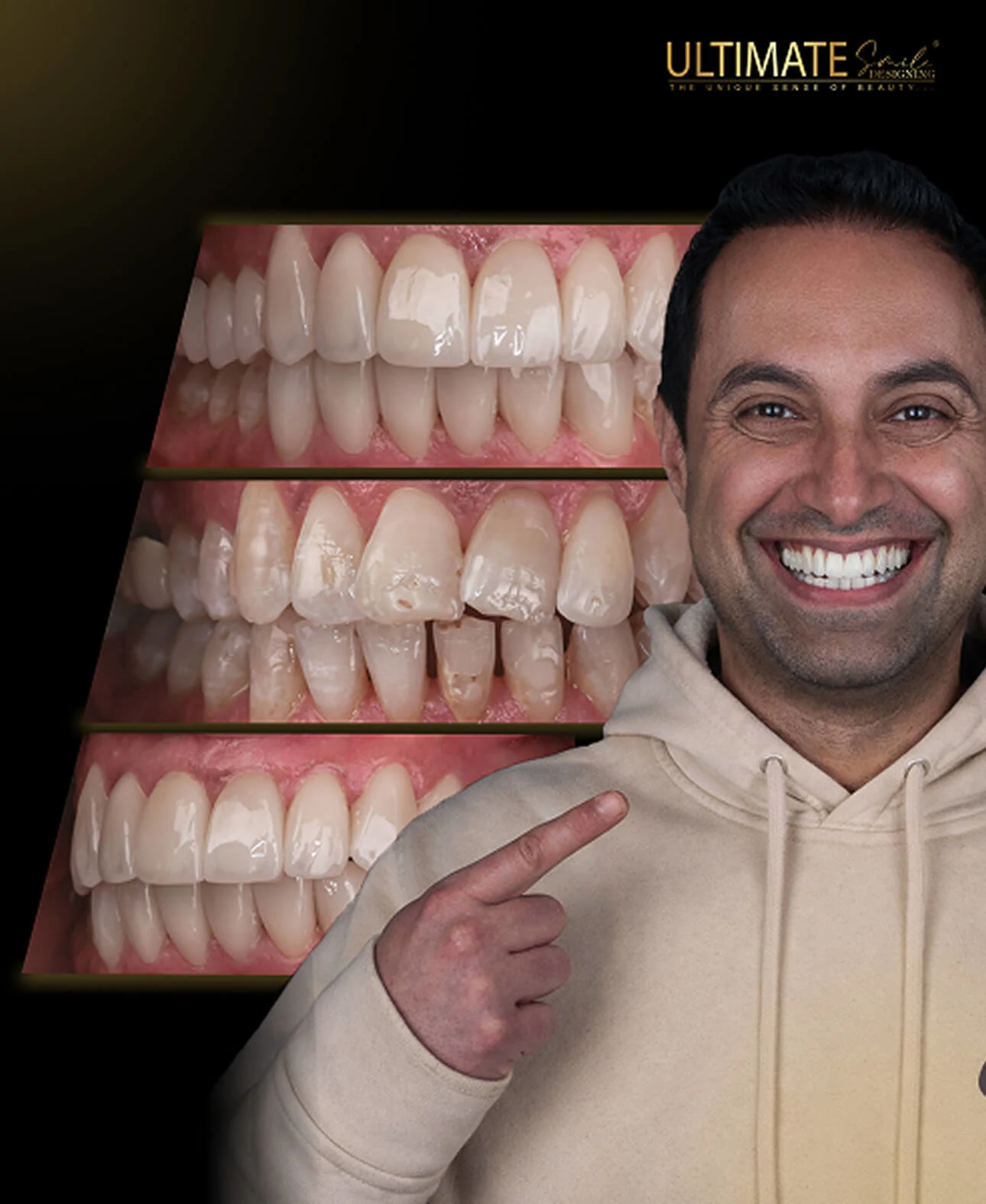 High-impact before-after visuals of confident smiles crafted by expert clinicians