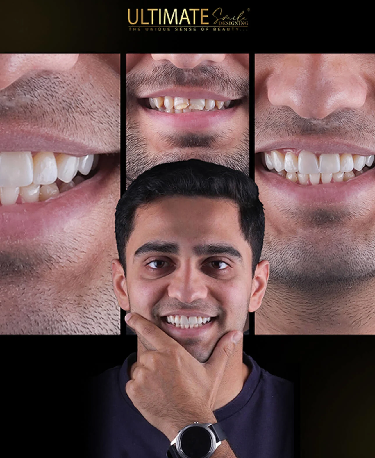 Image timeline of smile success stories from Ultimate Smile Design restorative care
