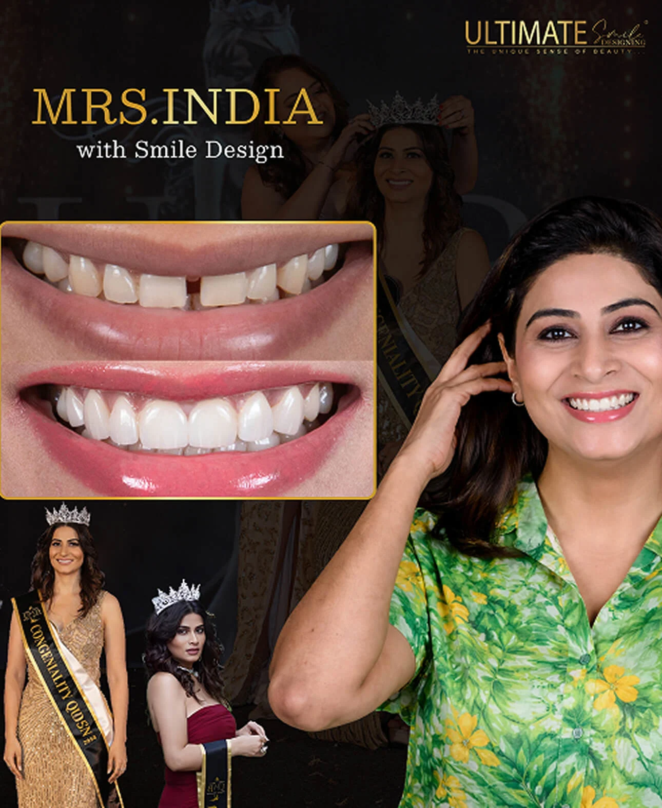 Visible dental improvements through advanced treatment shown in patient image timeline