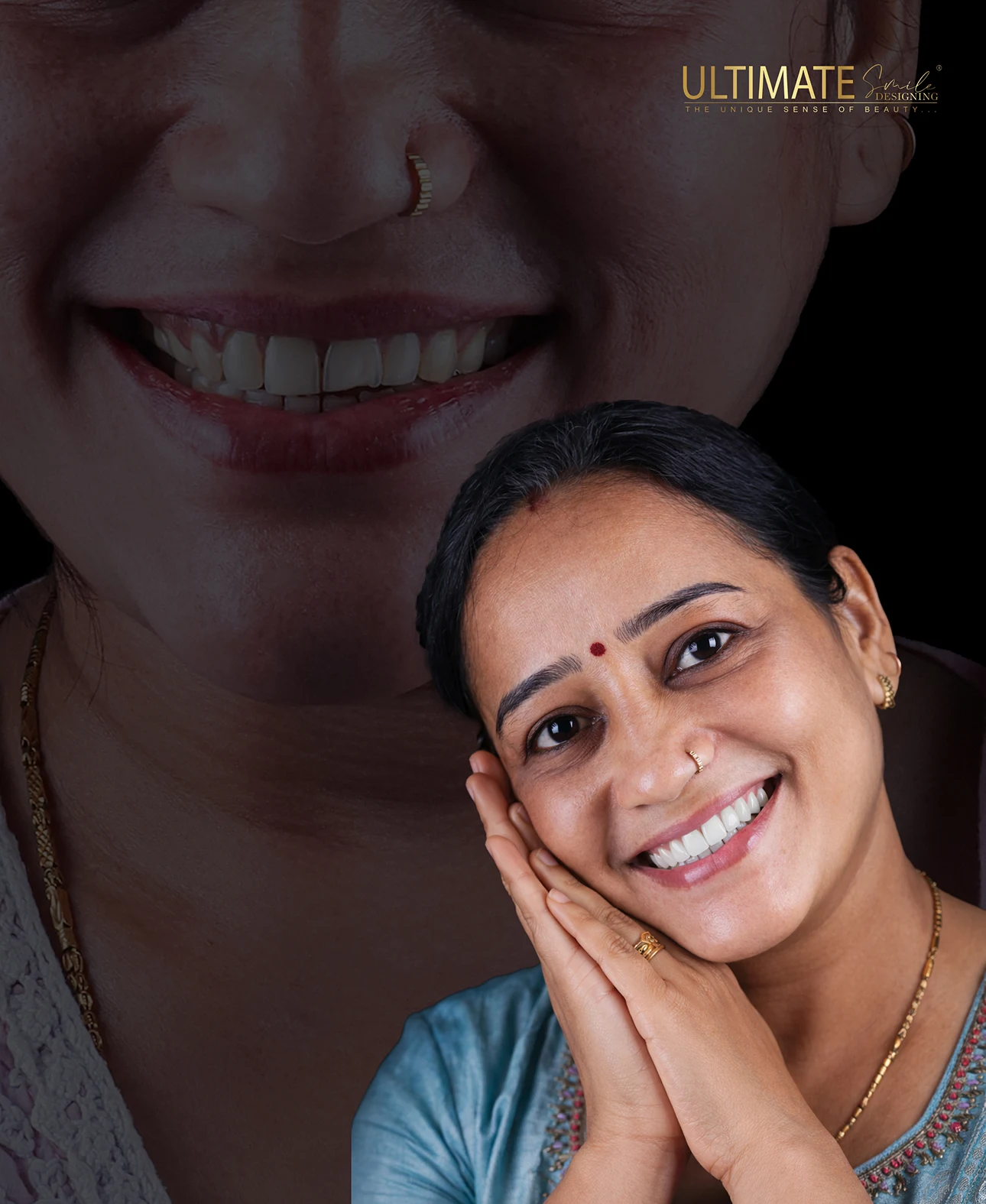 Smile makeover before-after display featuring real patient results at Ultimate Smile Design
