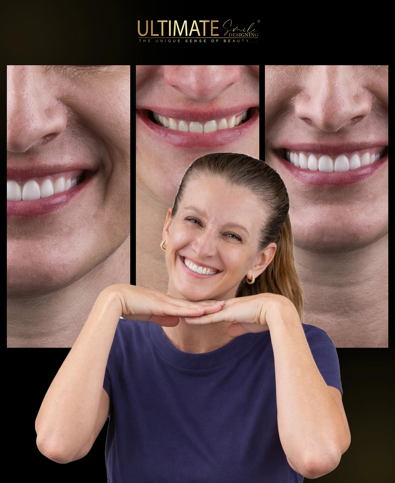 Patient journey from consultation to perfect smile in Ultimate Smile Design series