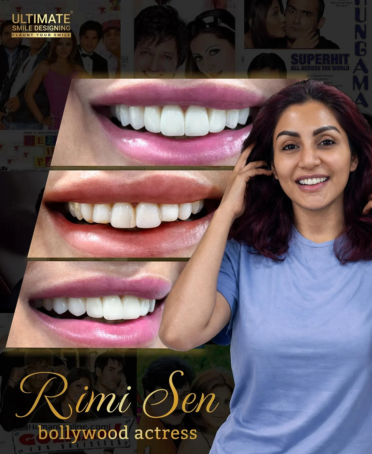Smile makeover before-after display featuring real patient results at Ultimate Smile Design