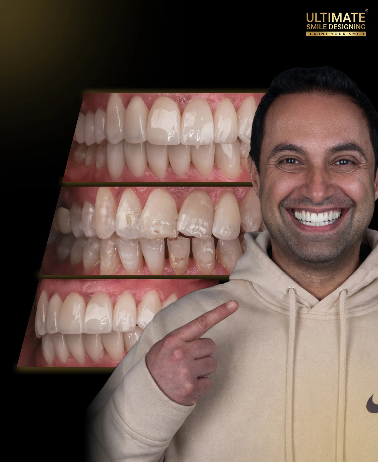 Gallery of restored smiles featuring aesthetic upgrades at Ultimate Smile Design center