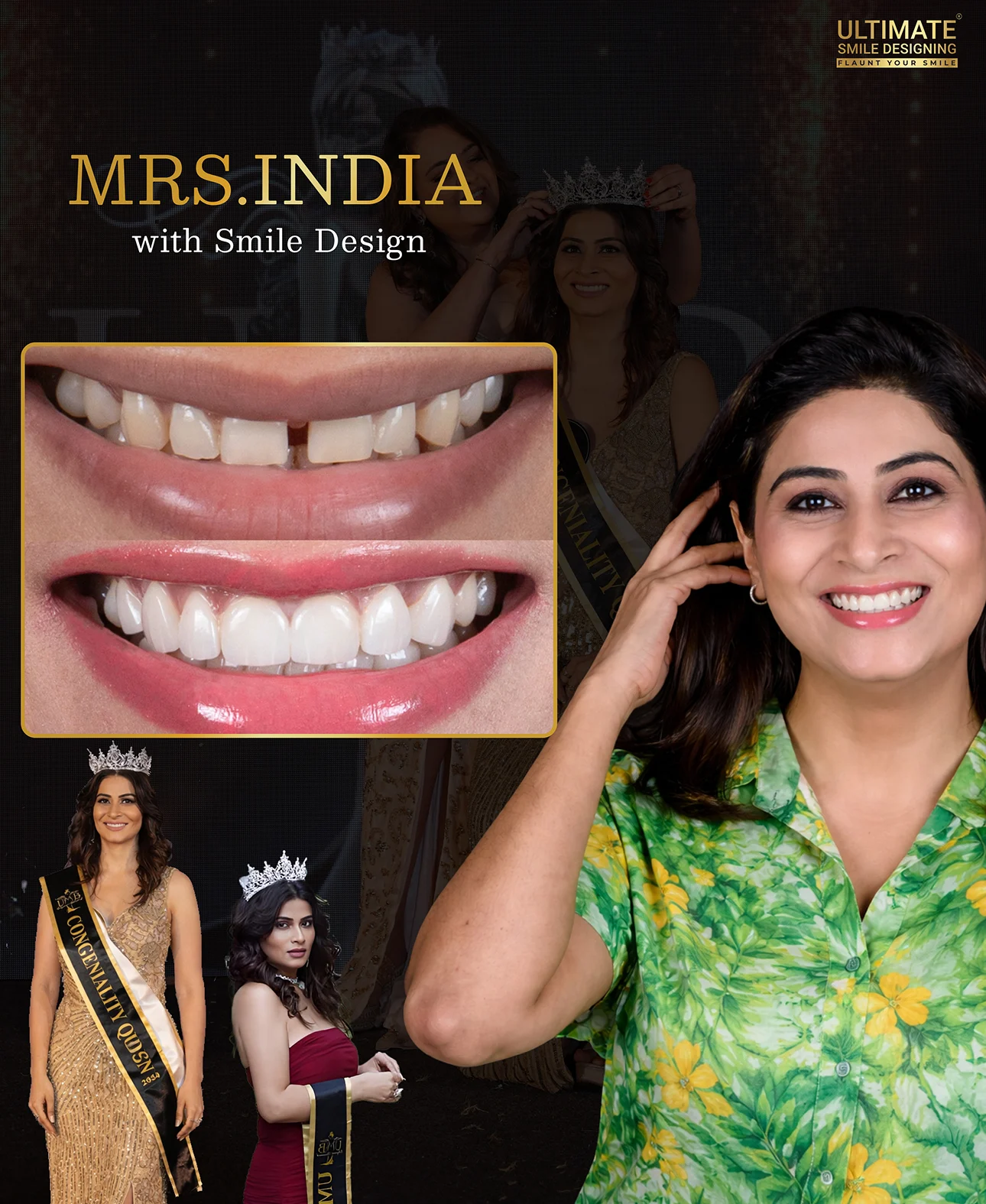 Visible dental improvements through advanced treatment shown in patient image timeline