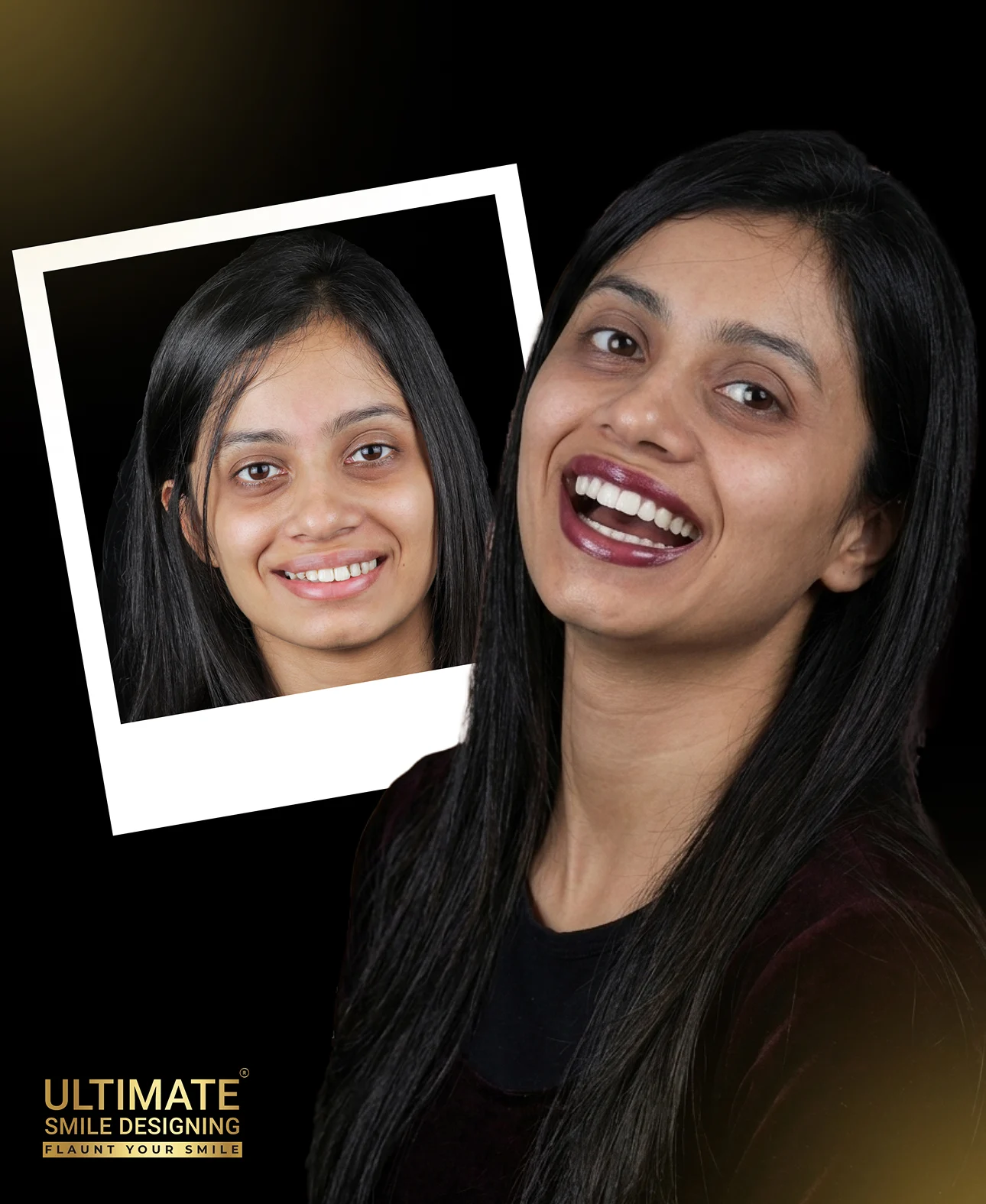 High-impact before-after visuals of confident smiles crafted by expert clinicians