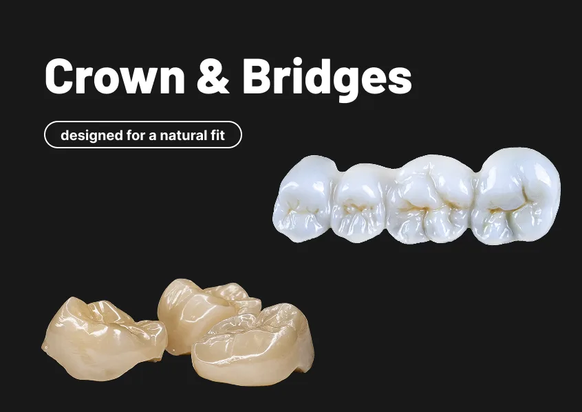product-crown&bridges