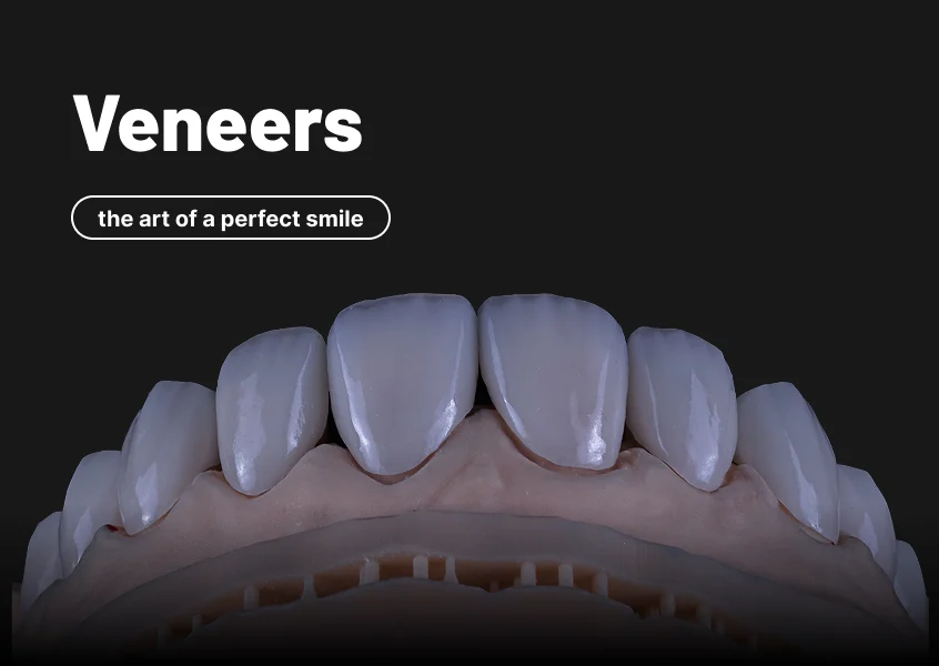 product-veneers