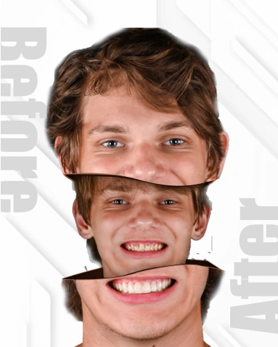 Final step confirming smile design schedule and treatment timeline with dental expert